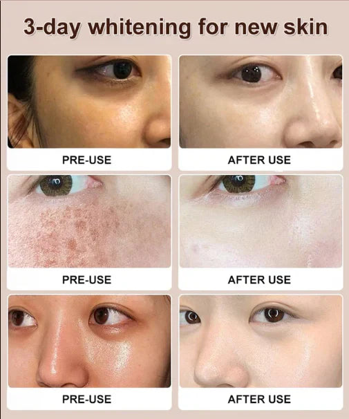 LAST DAY OF DISCOUNT 🔥 WHITENING CLEANSER